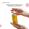Skin & Scar Oil | Organic Formula | Fast Absorbing | Non-Greasy | Reduces Stretch Marks & Scars | Hydrates & Nourishes Skin | 100ml | Natural Ingredients