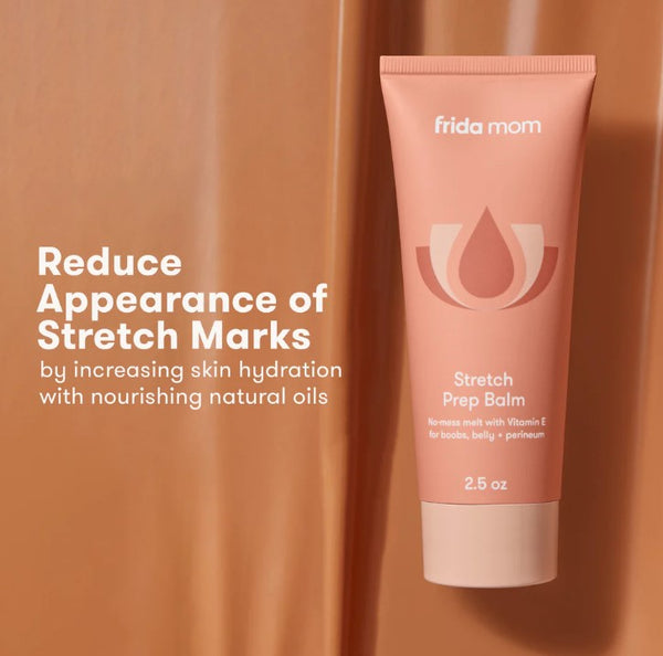 Frida Mom Stretch Mark Cream, Moisturizing Lotion for Stretch Marks and Perineal Massges with Vitamin E, 2.5oz